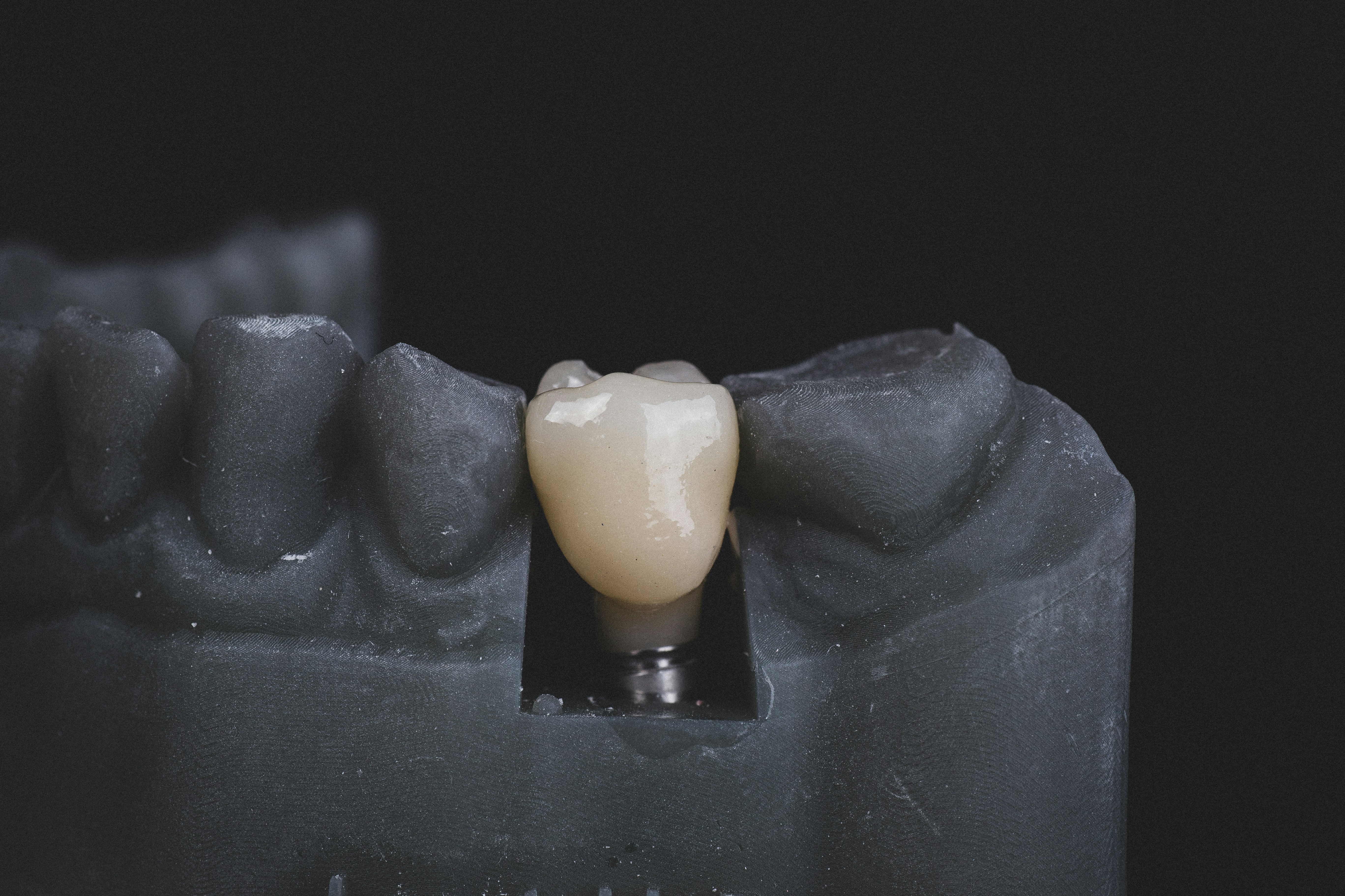 Implantology