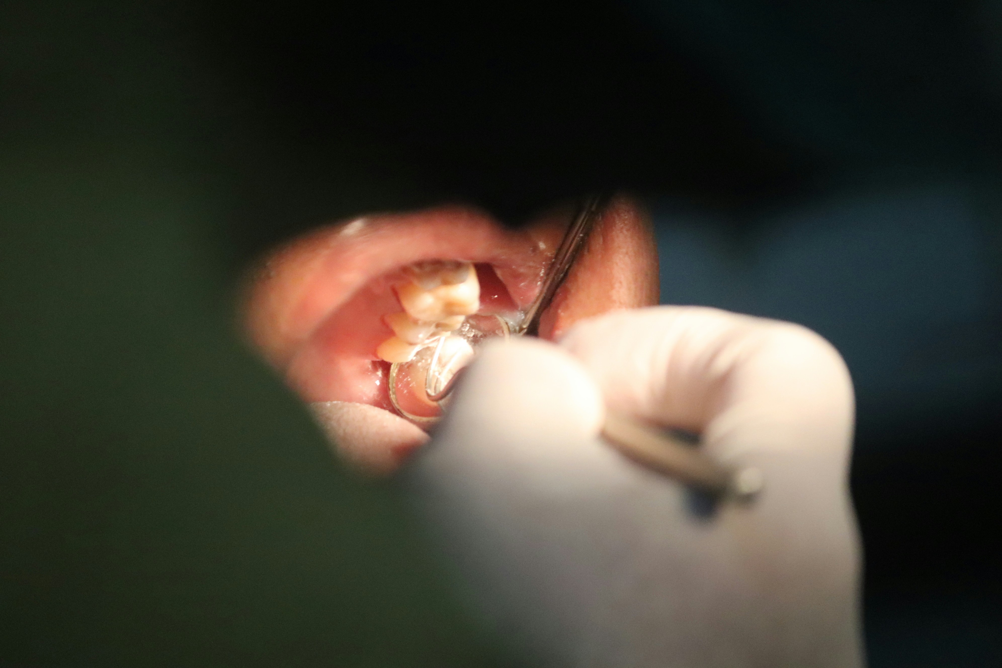 Oral Surgery