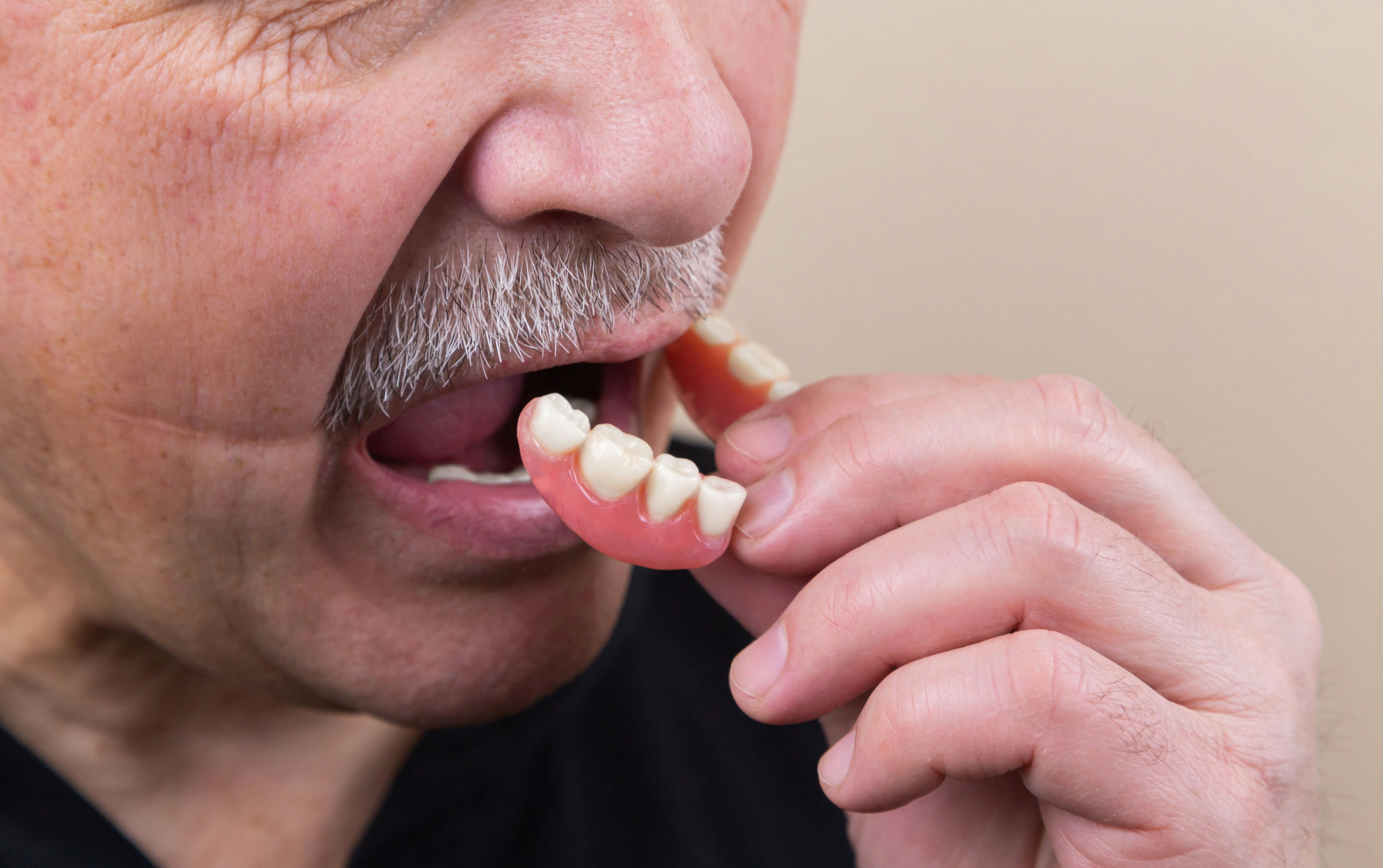 Prosthodontic Services